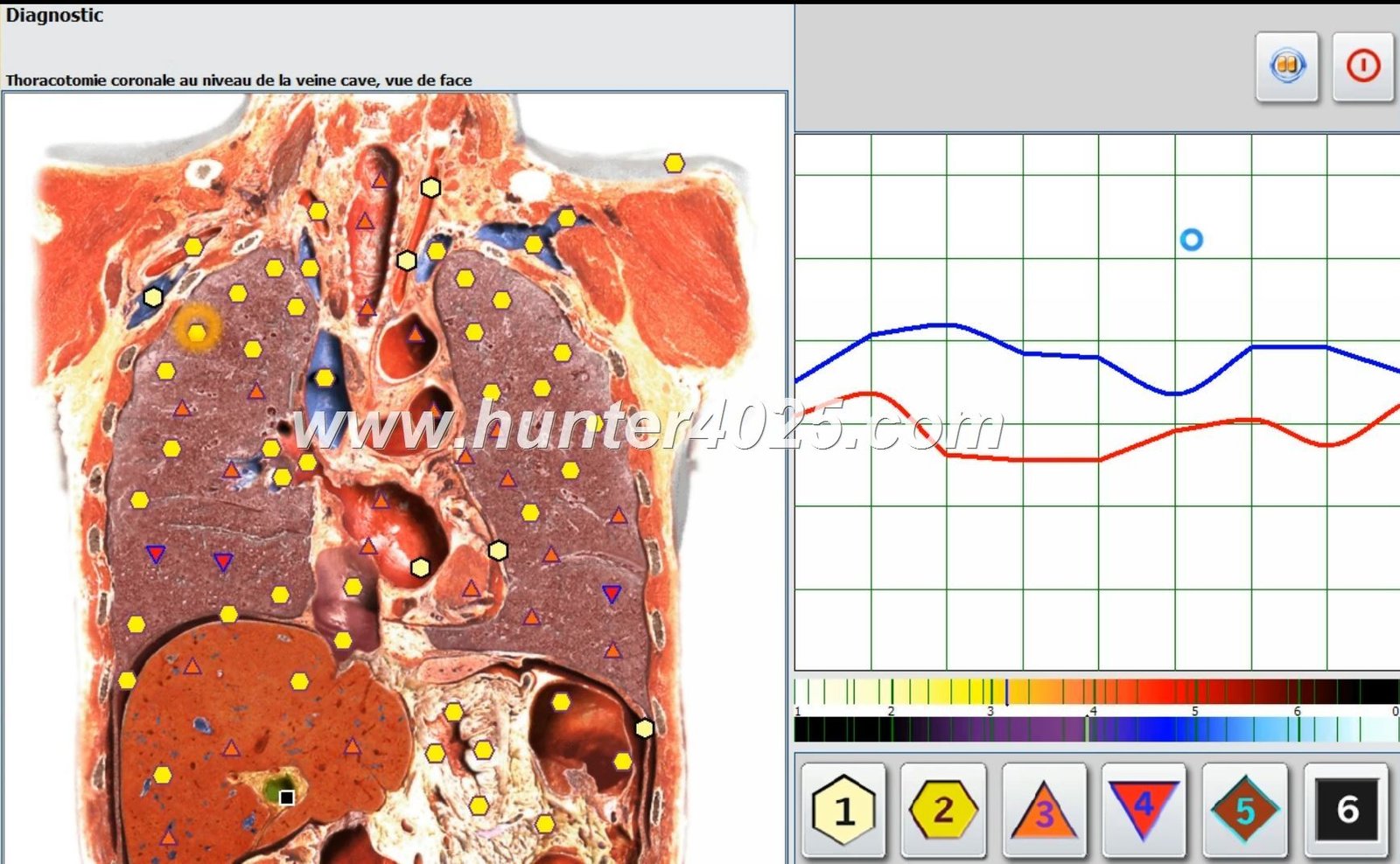 Metatron 4025 Precio