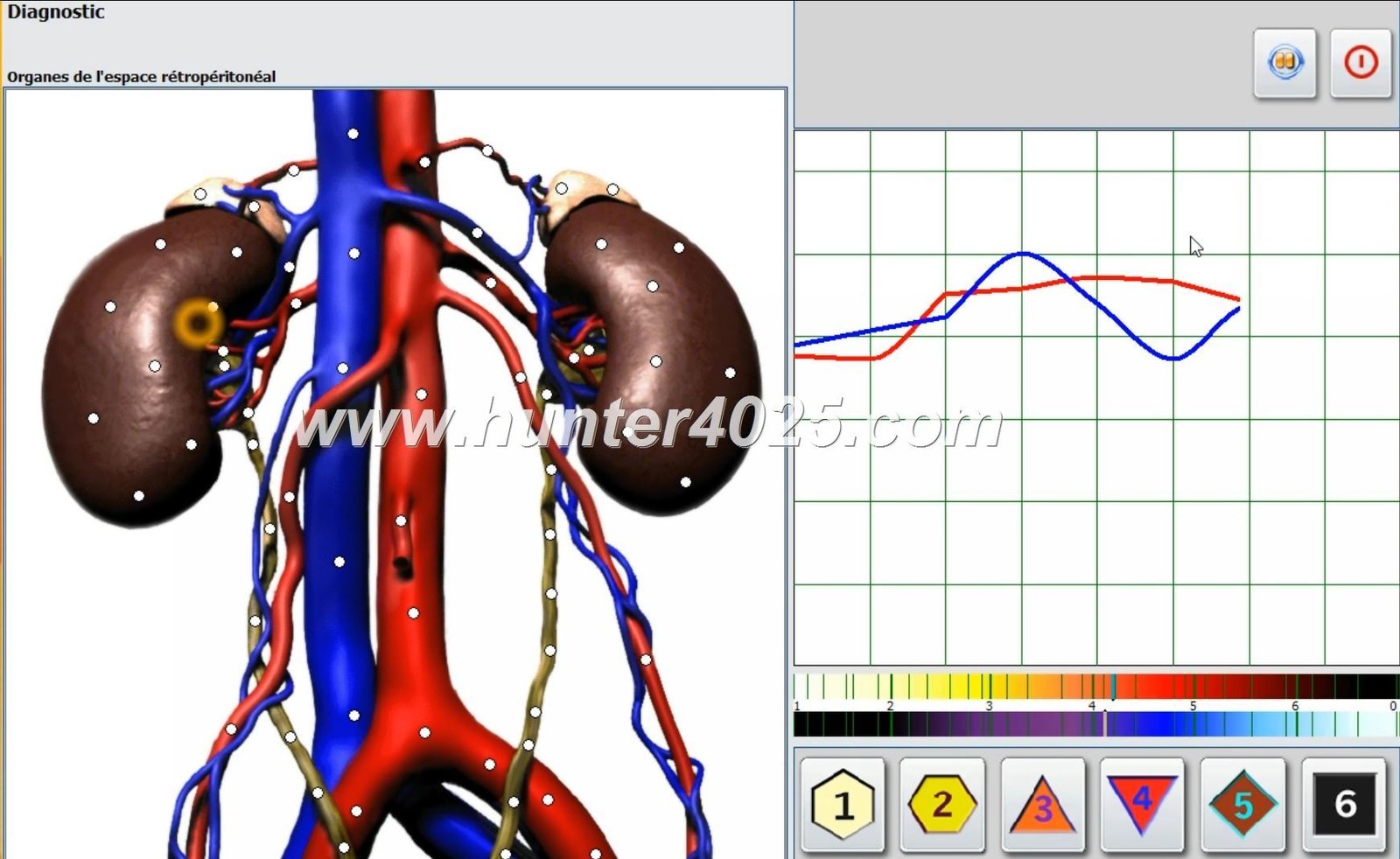 Metatron 4025 Precio