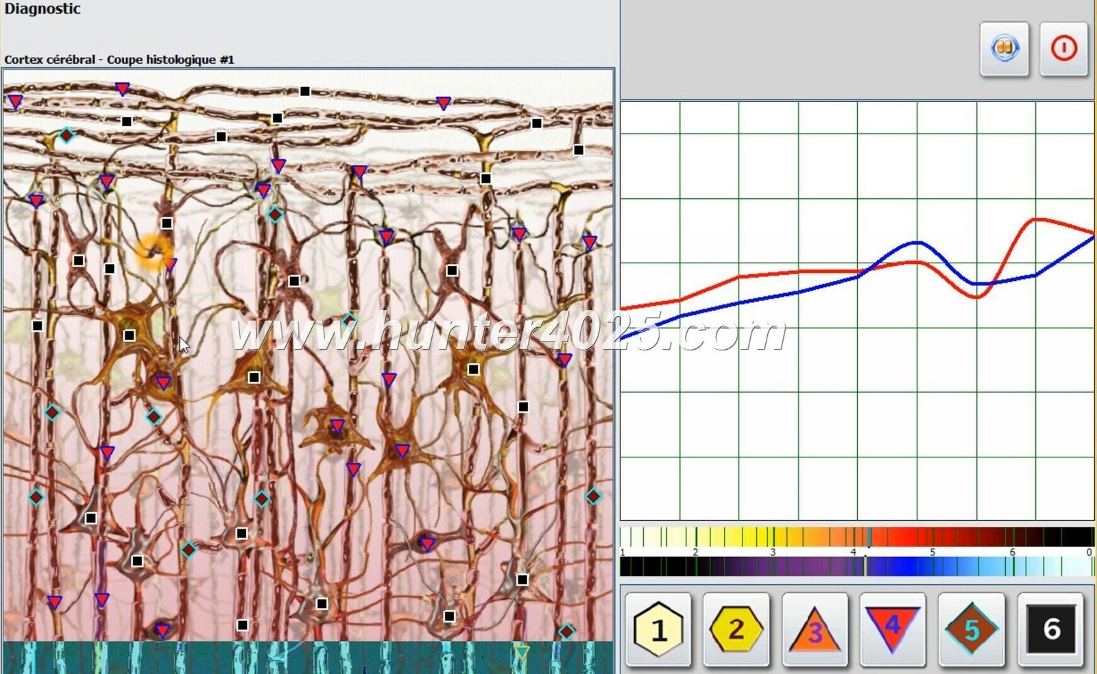 Metatron 4025 Precio