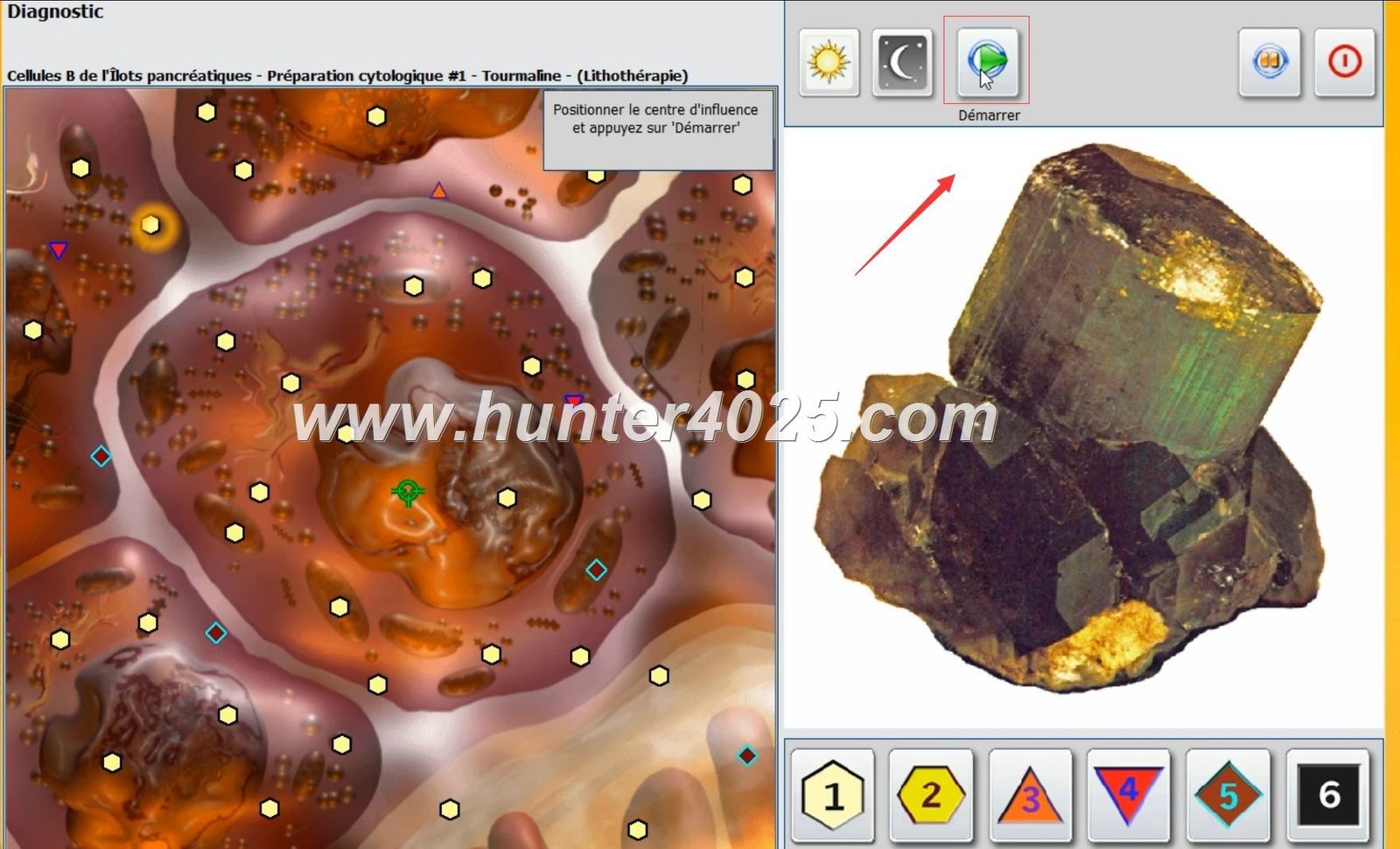 Metatron 4025 Precio