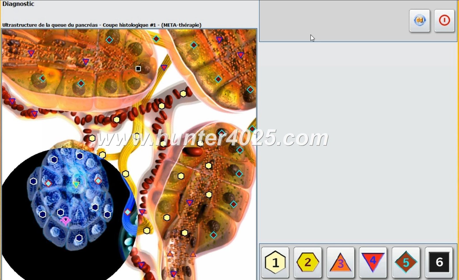 Metatron 4025 Precio