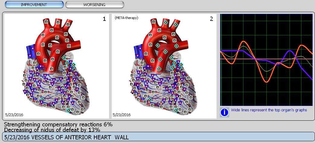 Metatron 4025 Precio