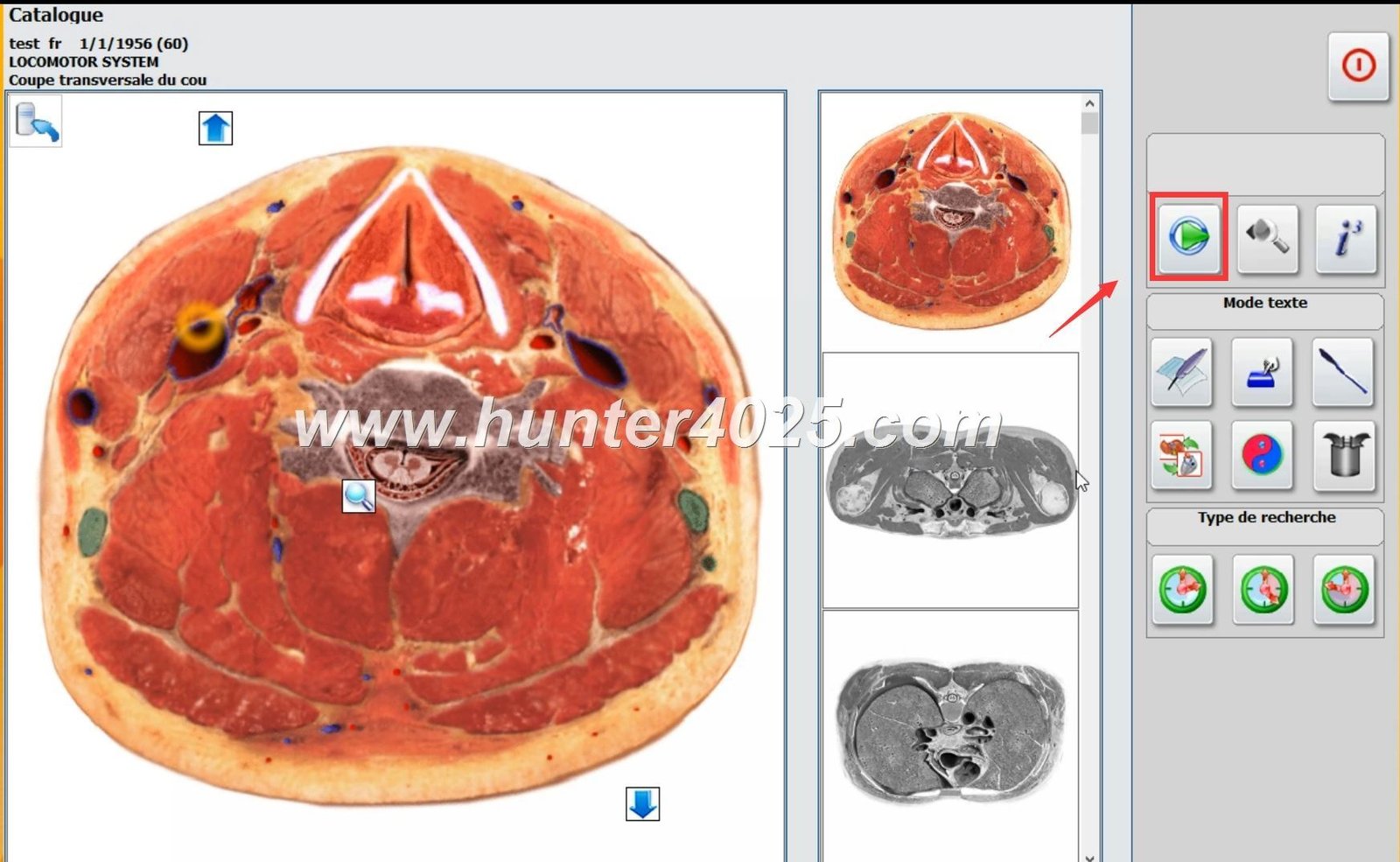 Metatron 4025 Precio