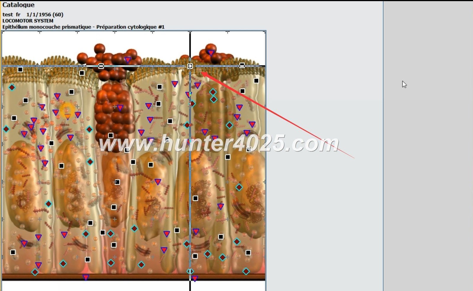 Metatron 4025 Precio