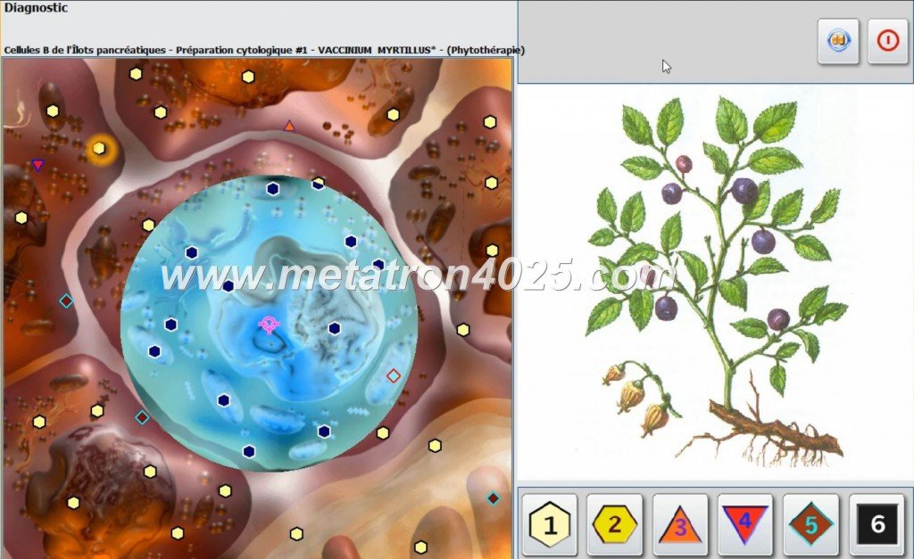 Sistema Metatron Hunter 4025 NLS en consultorio médico argentino