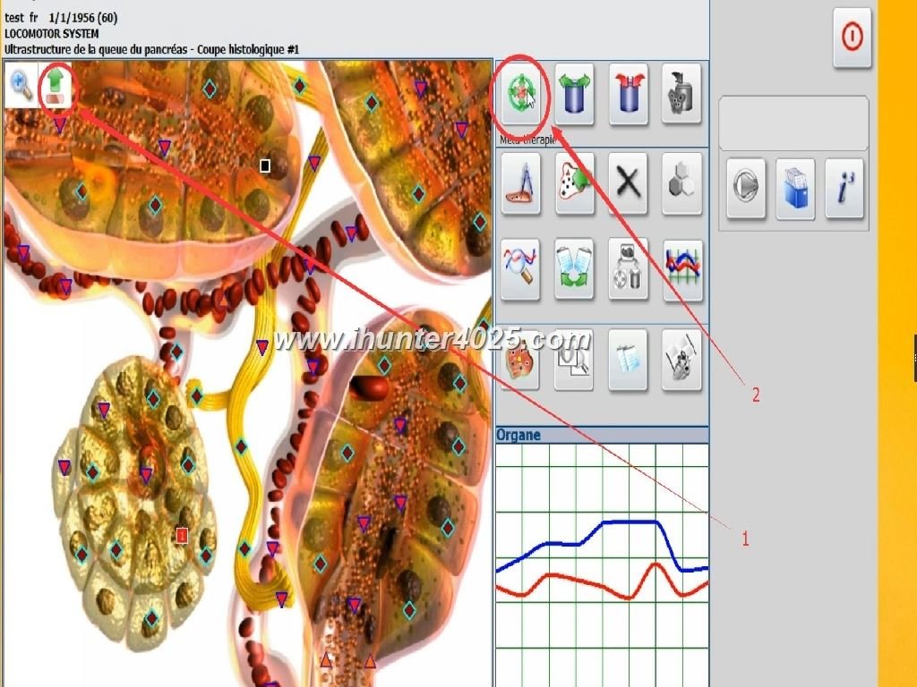 Metatron 4025 Metapathia GR Hunter