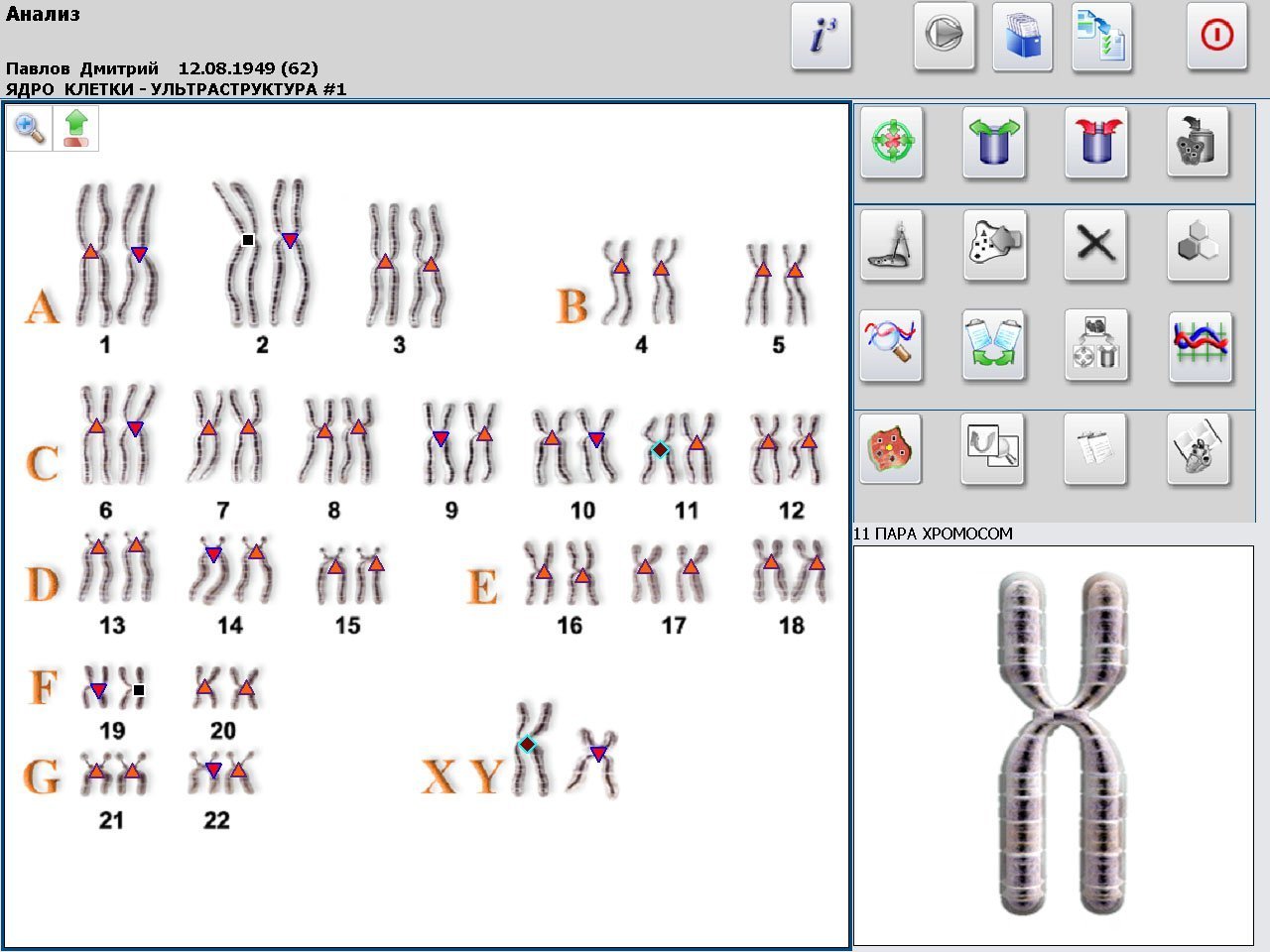 Metatron 4025 Metapathia GR Hunter