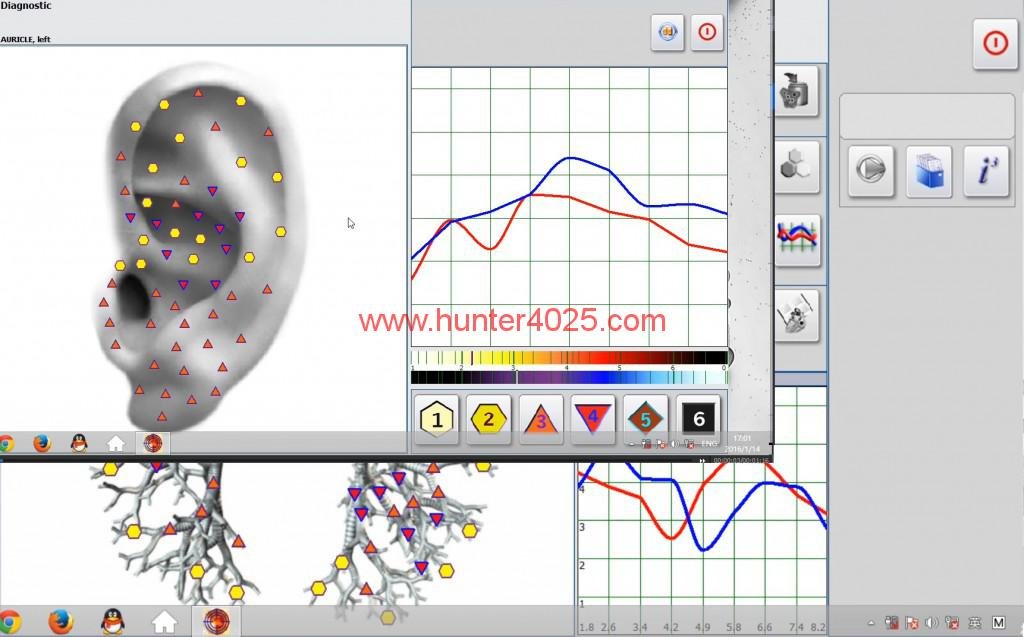 Metatron Hunter 4025 NLS