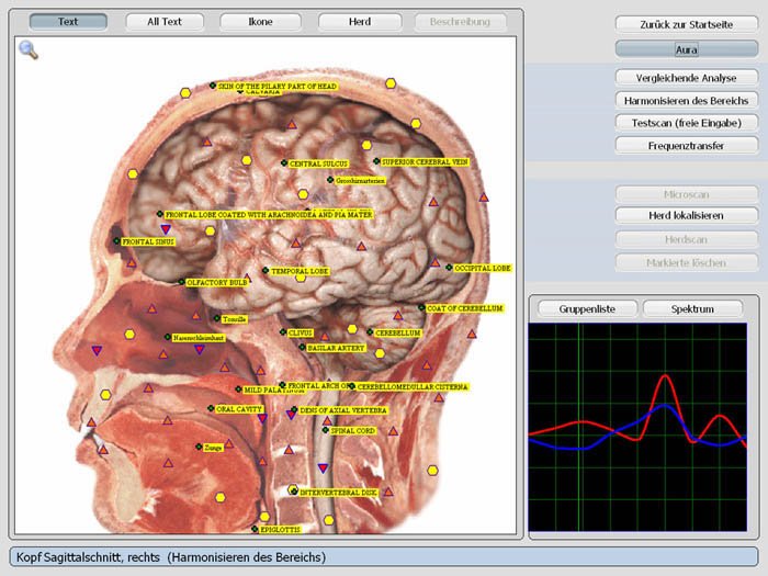 Metatron 4025 Metapathia GR Hunter