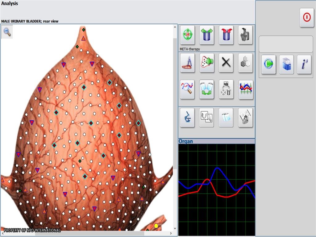 Metatron 4025 Metapathia GR Hunter