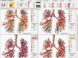 Metatron 4025 Metapathia GR Hunter