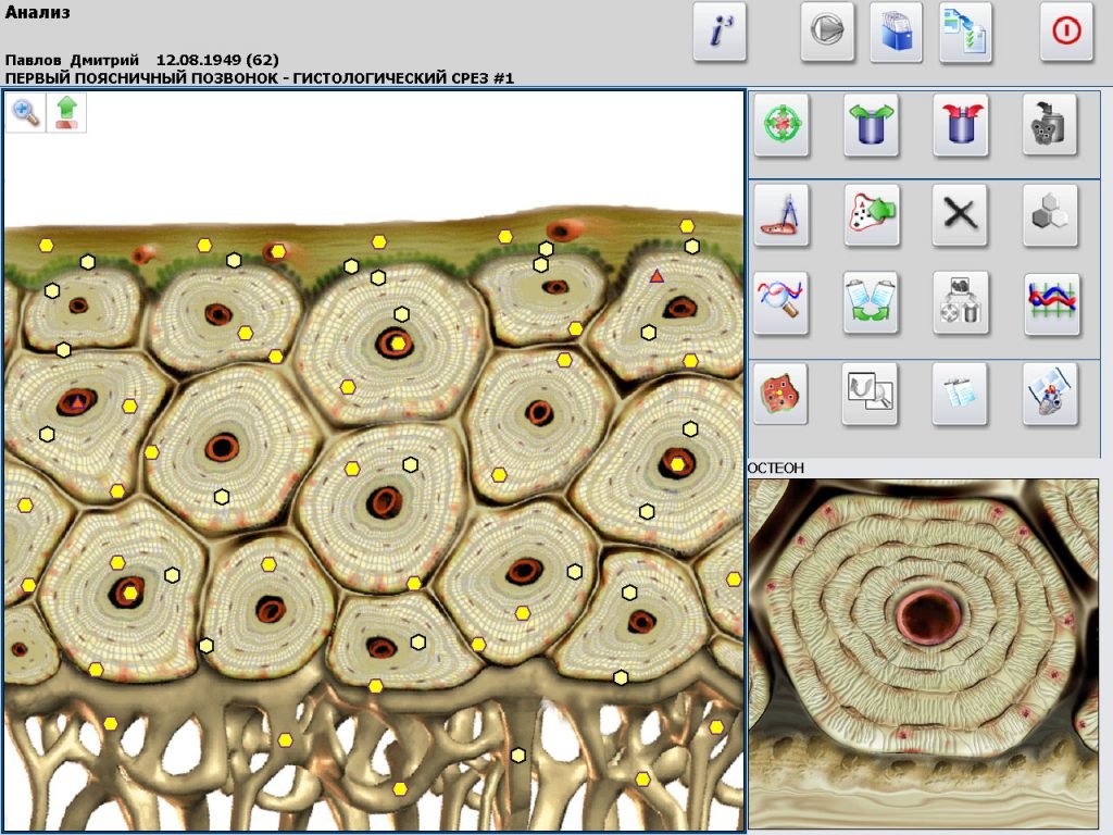 Metatron 4025 Metapathia GR Hunter