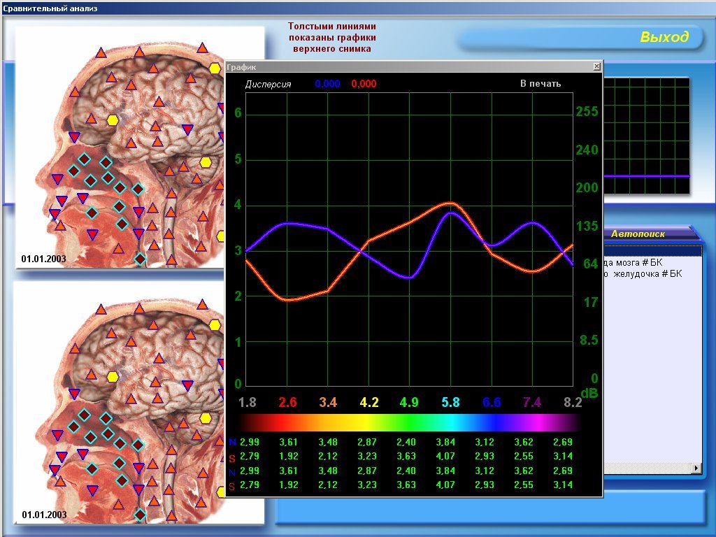 Metatron Hunter 4025