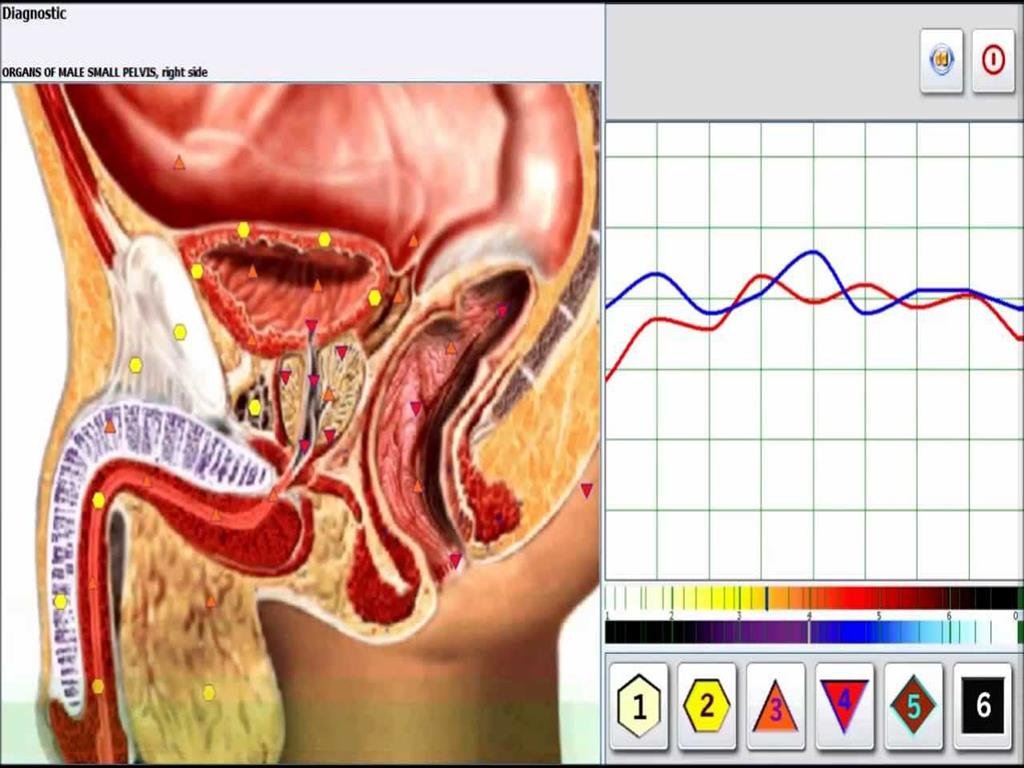 Metatron Hunter 4025 en Argentina