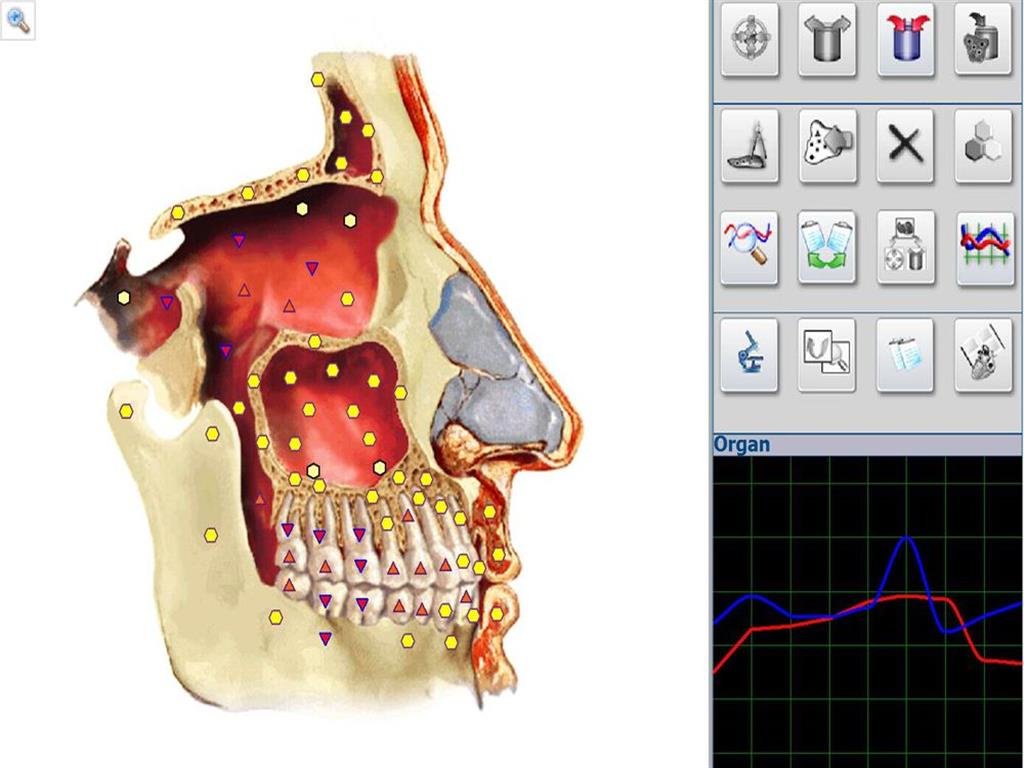 Metatron Hunter 4025 en Argentina