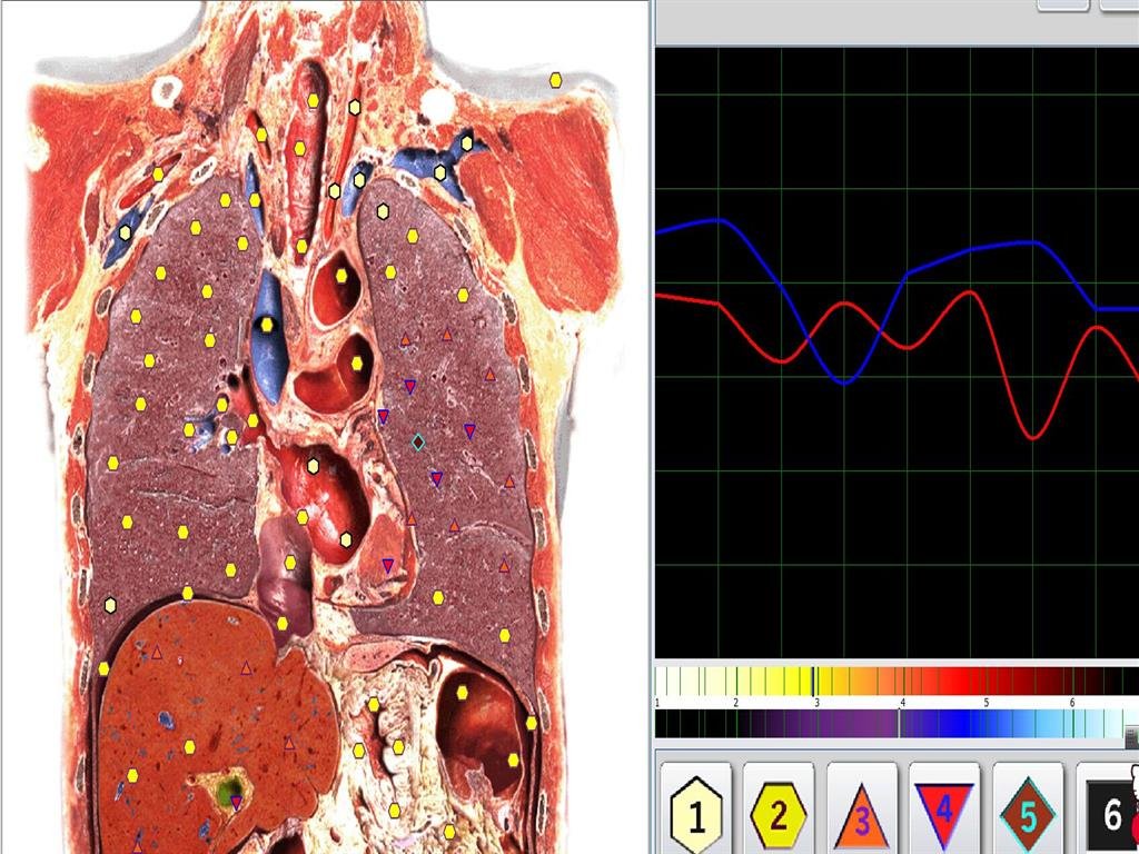 Metatron Hunter 4025 en Argentina