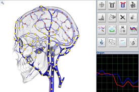 Metatron Hunter 4025 en Argentina
