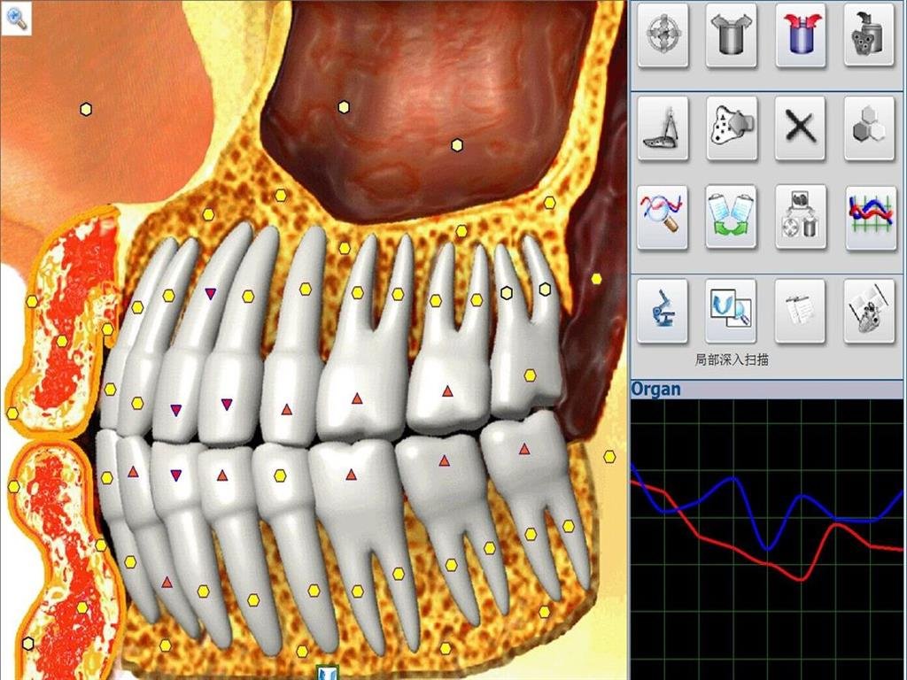 Metatron Hunter 4025 en Argentina