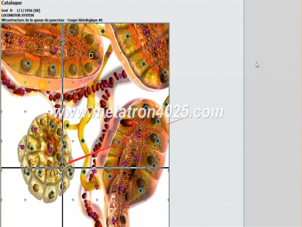 Metatron Hunter 4025 en Argentina