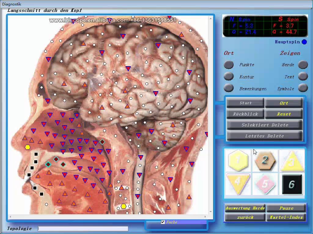 Metatron Hunter 4025 NLS