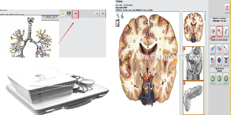 Metatron Hunter 4025 Precio