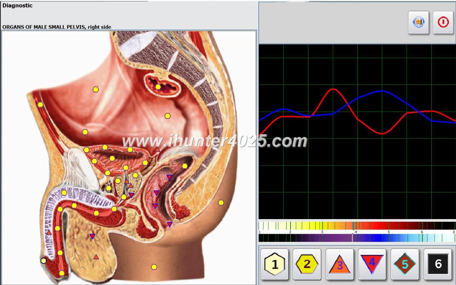 Metatron Hunter 4025 Preço