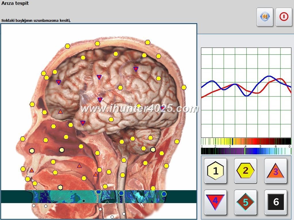 Metatron Hunter 4025 Preço