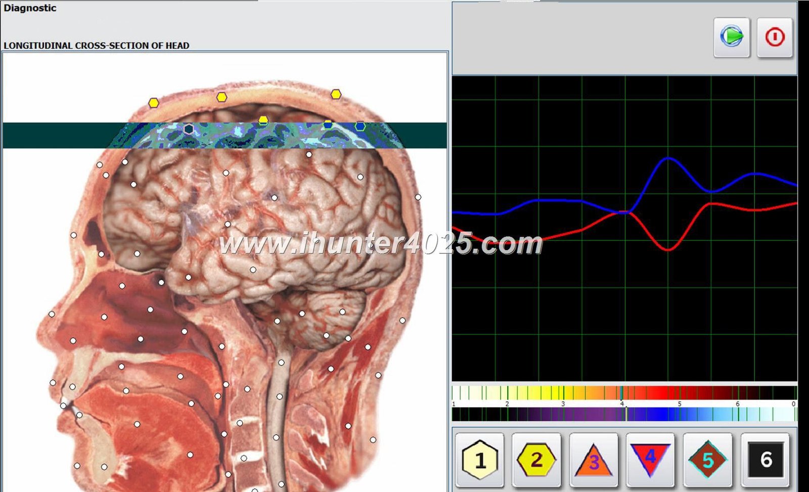 Metatron Hunter 4025 Preço