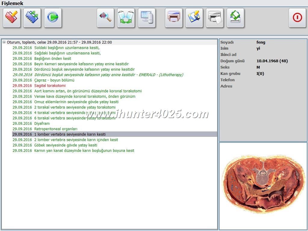 Metatron Hunter 4025 Preço