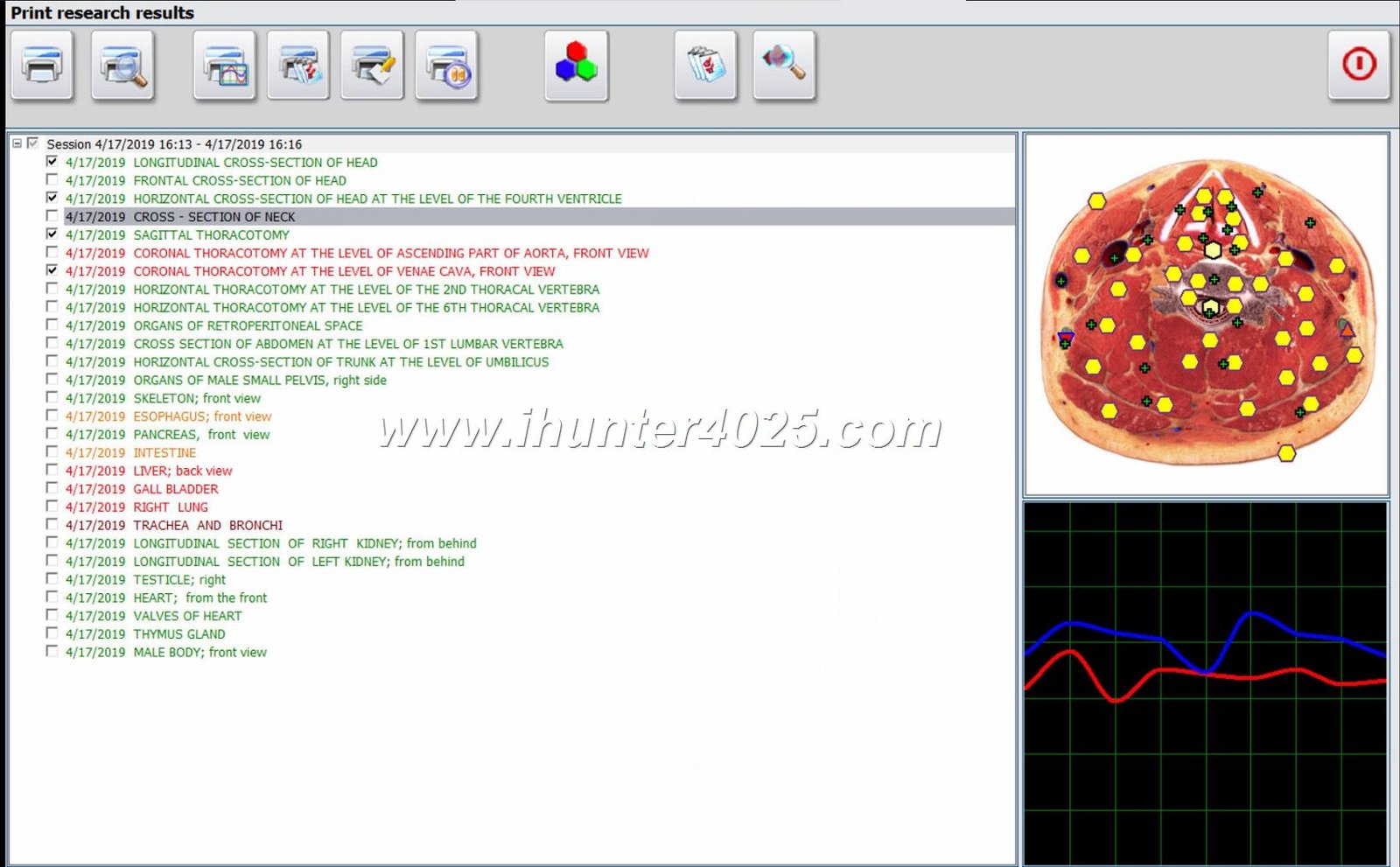 Metatron Hunter 4025 Preço