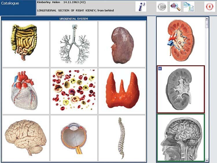 Metatron Hunter 4025 en Colombia
