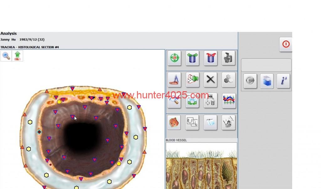 Metatron Hunter 4025 en Colombia