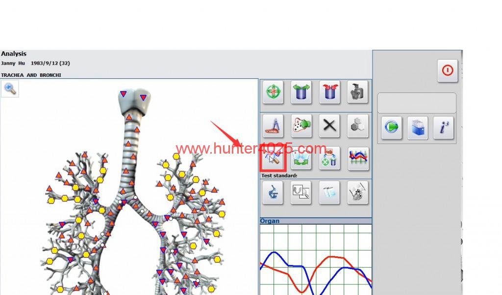 Metatron Hunter 4025 en Colombia