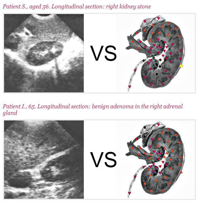 Metatron Hunter 4025 Preço