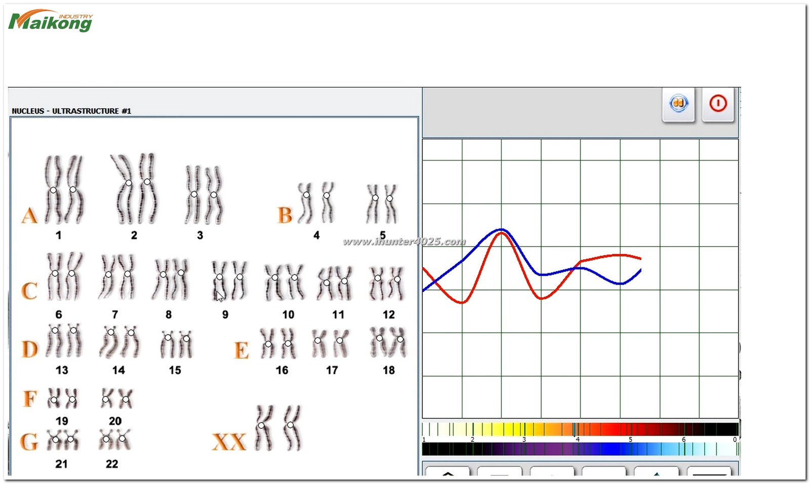 software del Metatron Hunter 4025