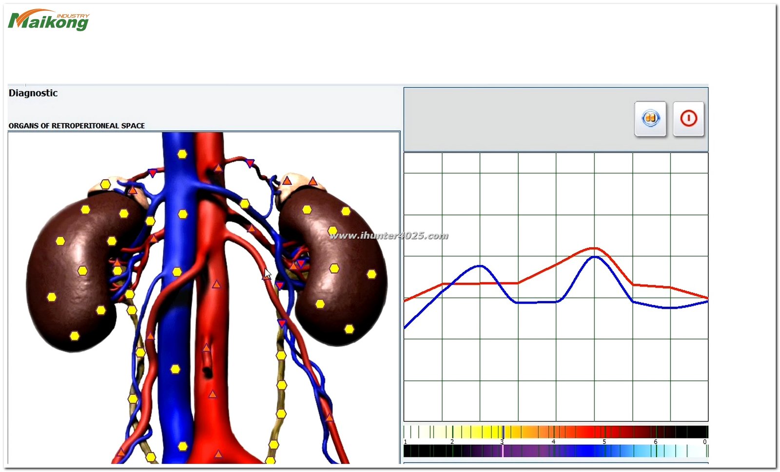 software Metatron Hunter 4025 NLS