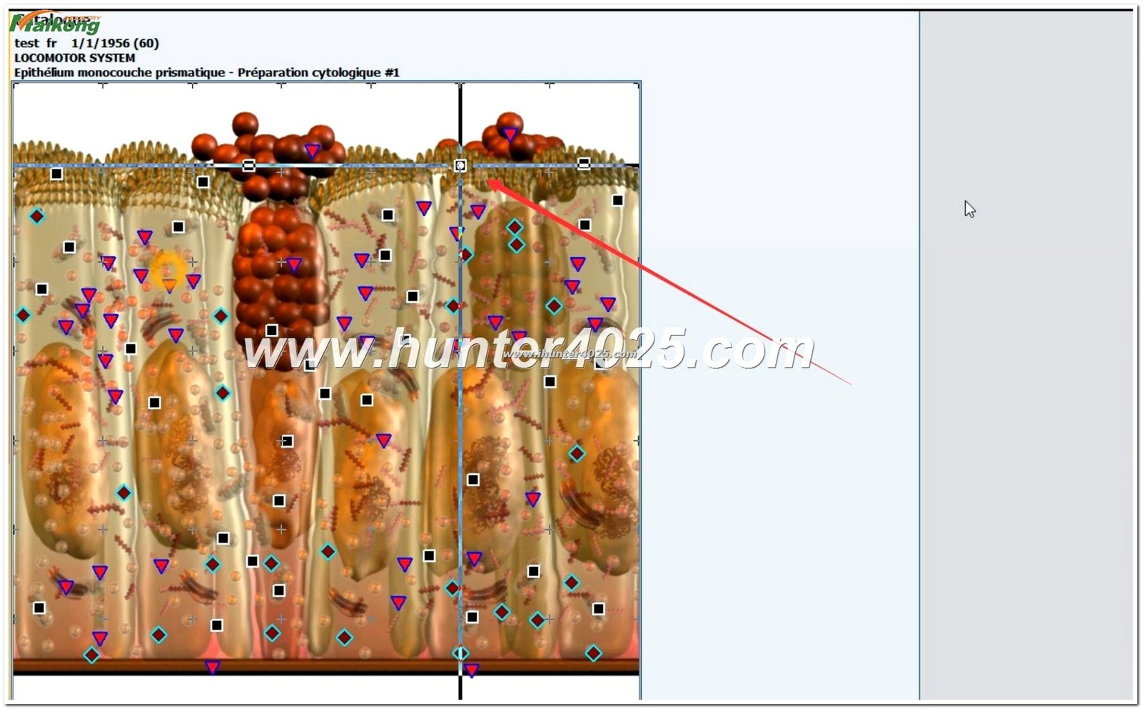 Metatron Hunter 4025 NLS