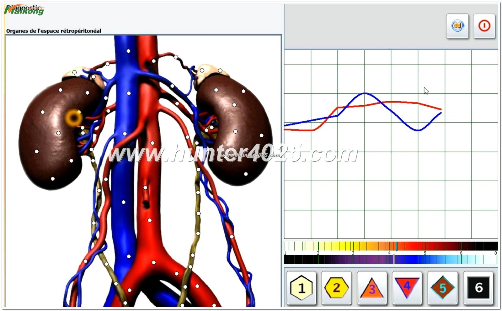 Metatron Hunter 4025 NLS