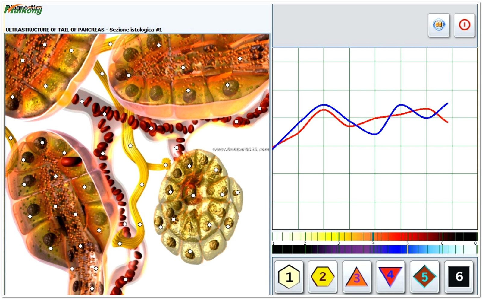 informes del software Metatron Hunter 4025 NLS