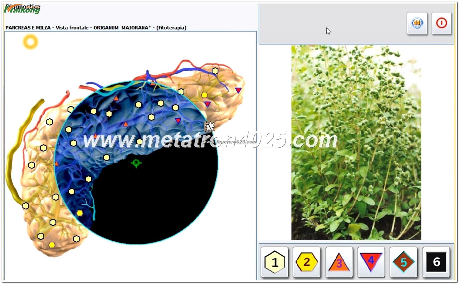 Metatron Hunter 4025 NLS