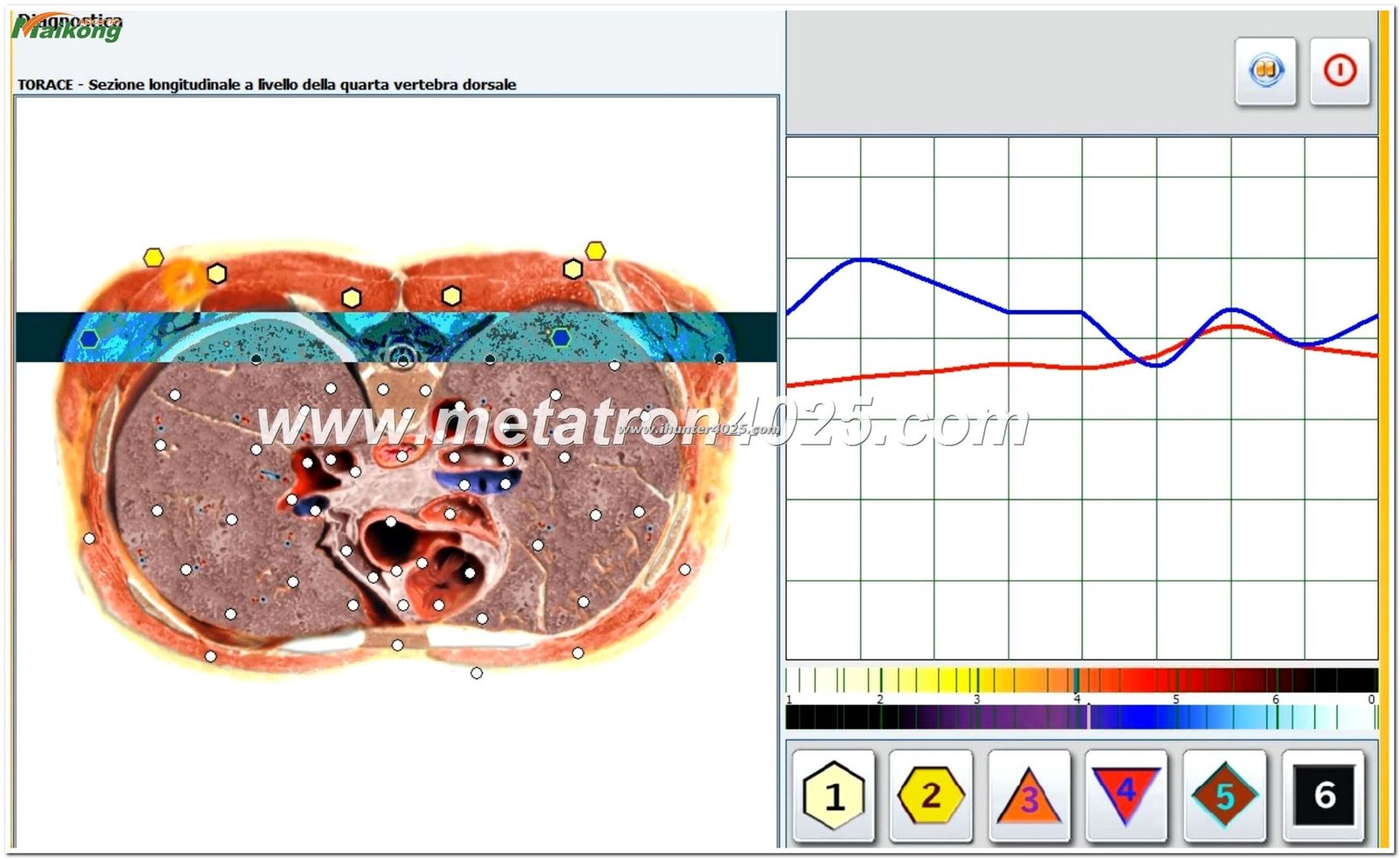 Resonante con el Metatron Hunter 4025 NLS