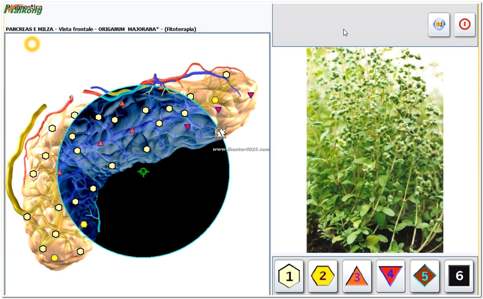 Metatron Hunter 4025 NLS