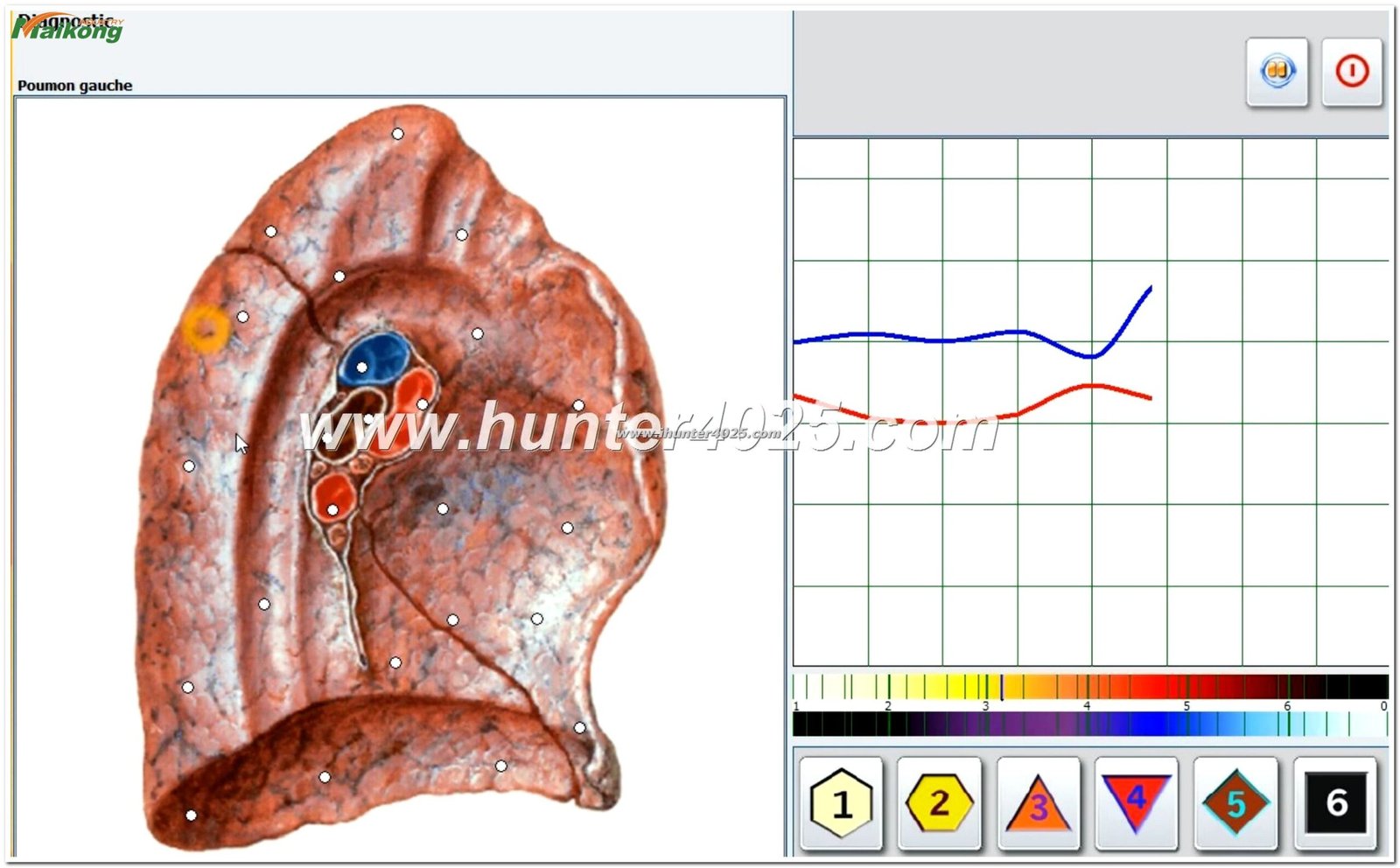 Tecnología de biorresonancia del Metatron Hunter 4025 NLS mostrando ondas electromagnéticas interactuando con tejidos biológicos
