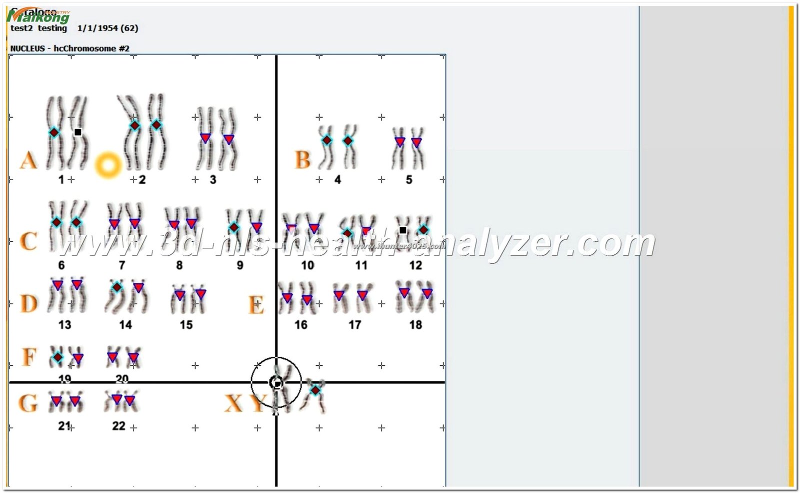 software del Metatron Hunter 4025