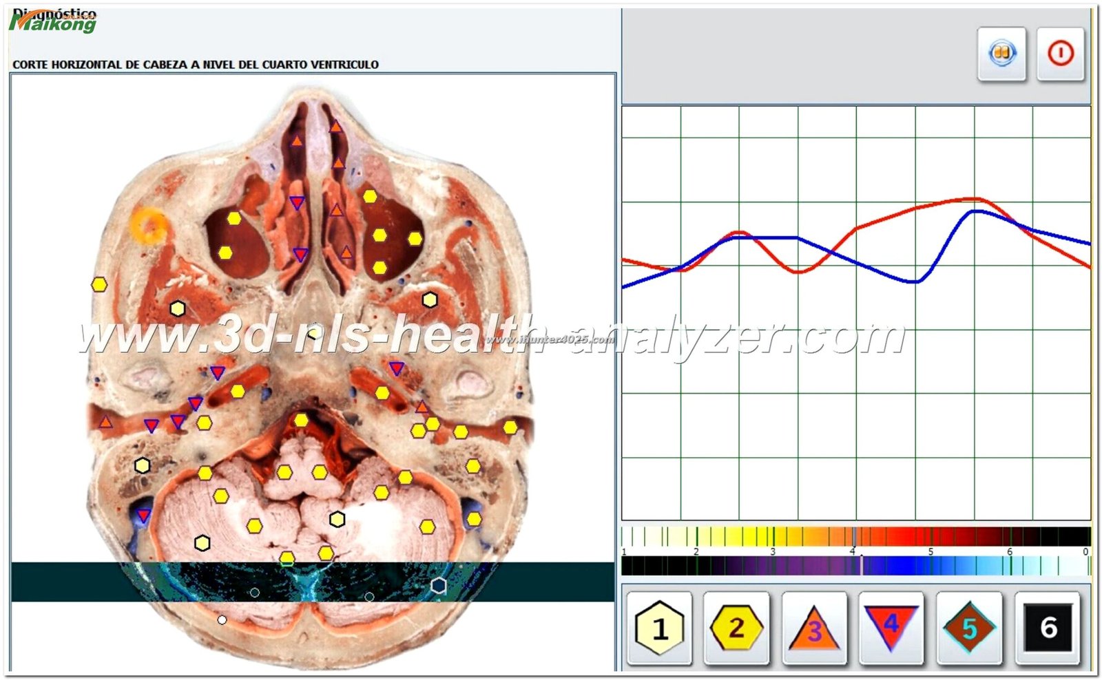Metatron Hunter 4025 NLS