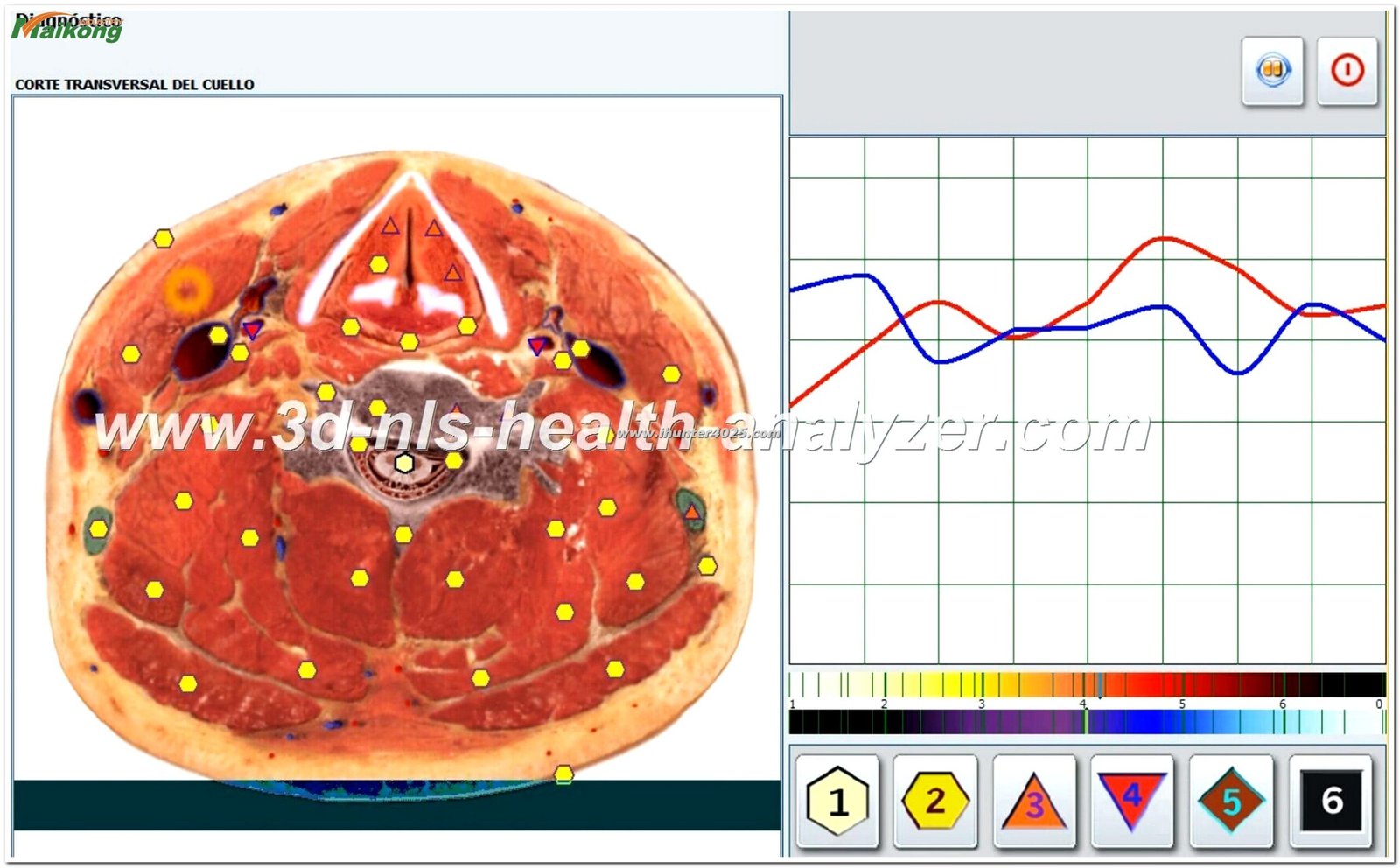 Dispositivo Metatron Hunter 4025 NLS mostrando el modo terapia en pantalla