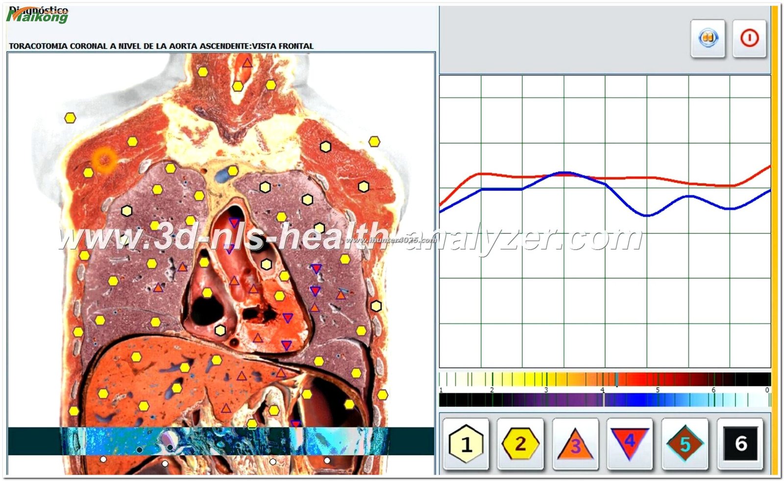 Metatron Hunter 4025 NLS