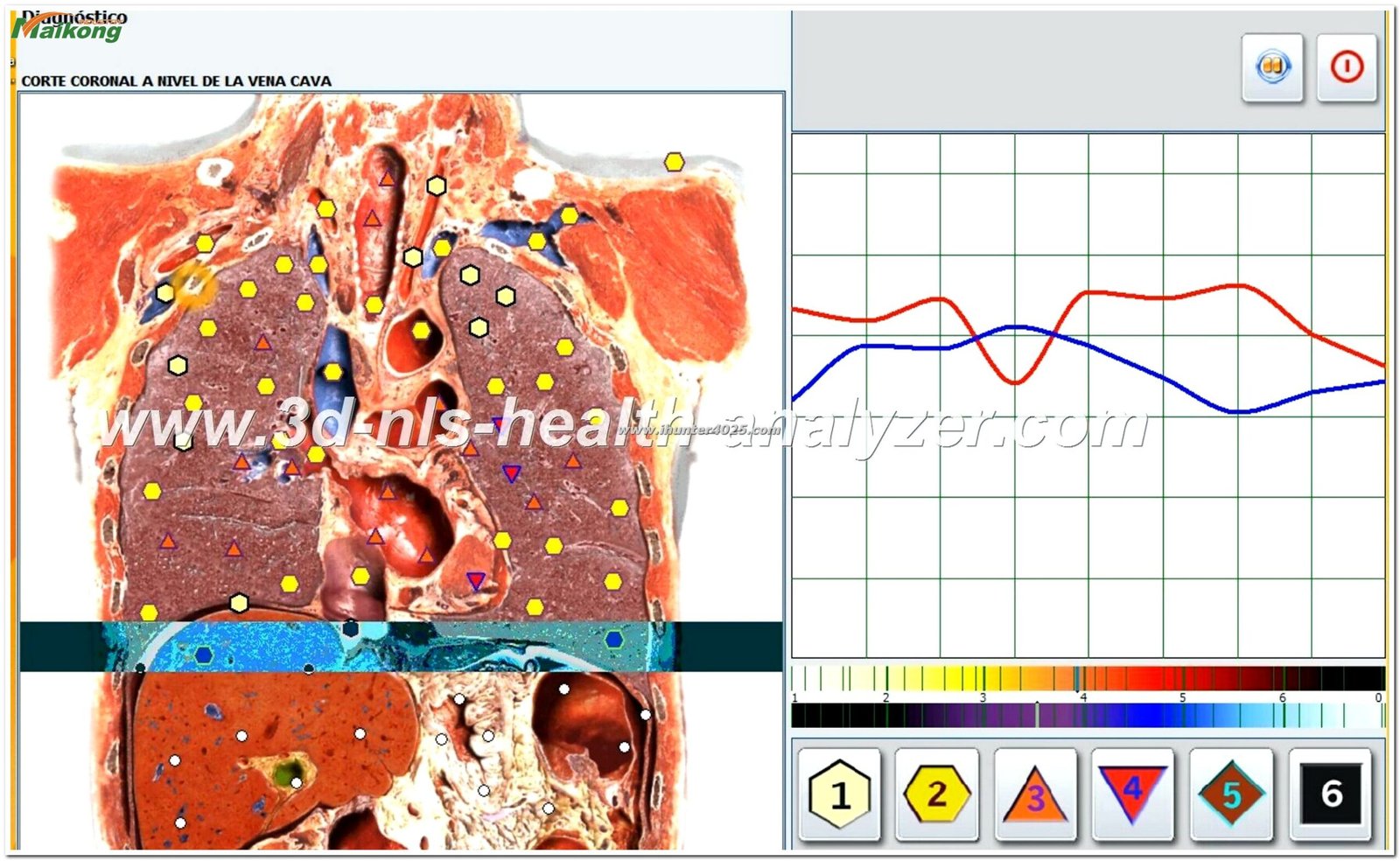 Metatron Hunter 4025 NLS