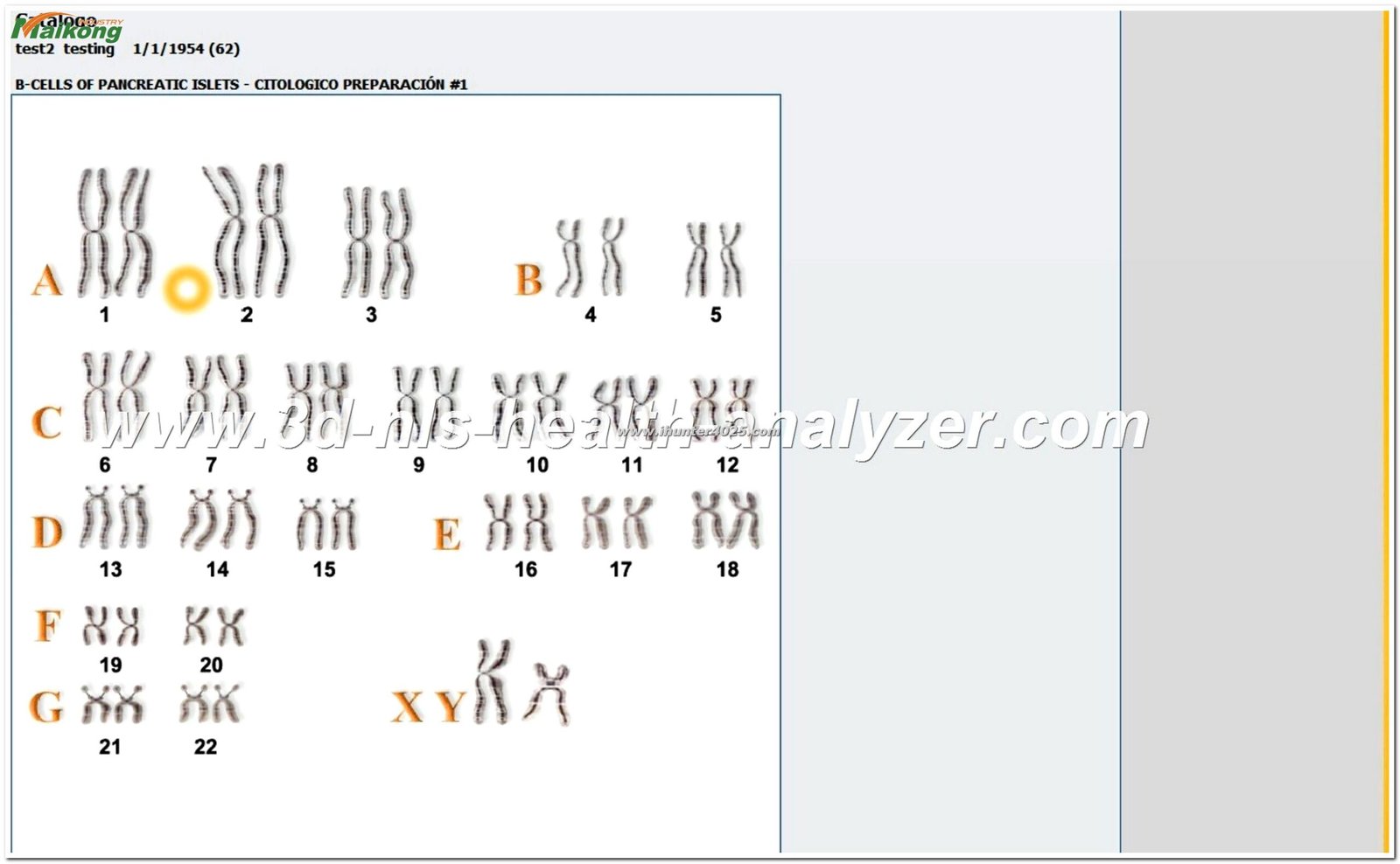 software del Metatron Hunter 4025