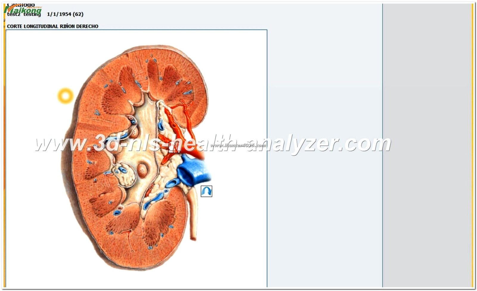 informes del software Metatron Hunter 4025 NLS